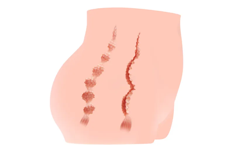 Cherry Masturbator – Bild 5