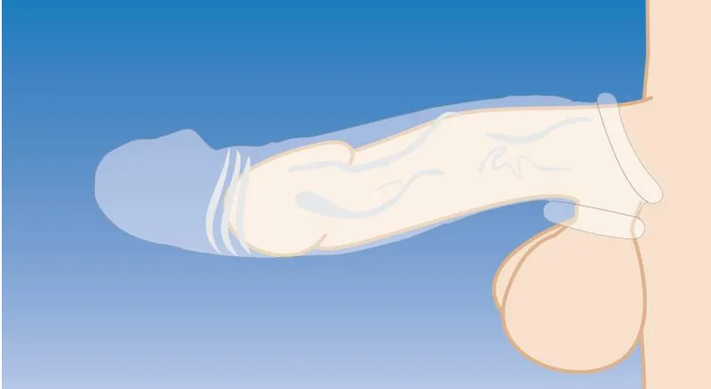 Size Matters - Clear Extender gekrümmte Penis-Hülle – Bild 5