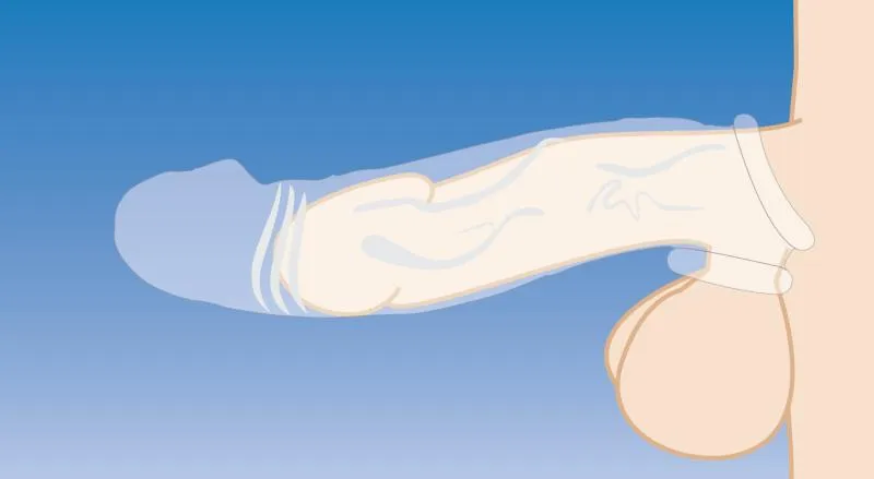 Size Matters - Clear Extender gekrümmte Penis-Hülle – Bild 5