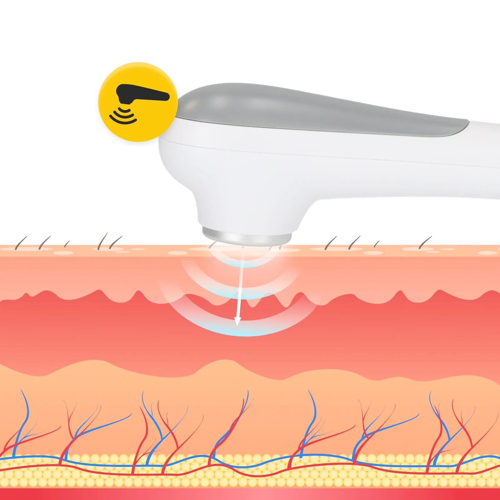 Nešiojamas ultragarso ir sonoterapijos prietaisas PRO+
