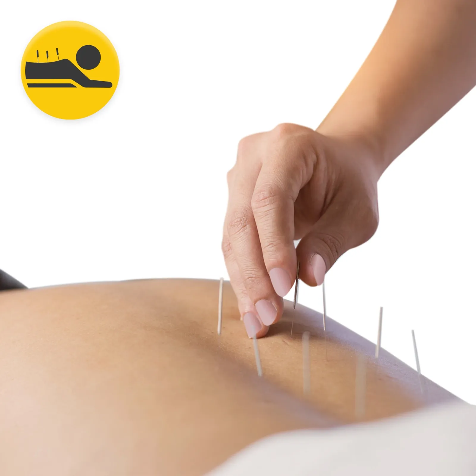 Akupunktūros adatos su kreiptuvu